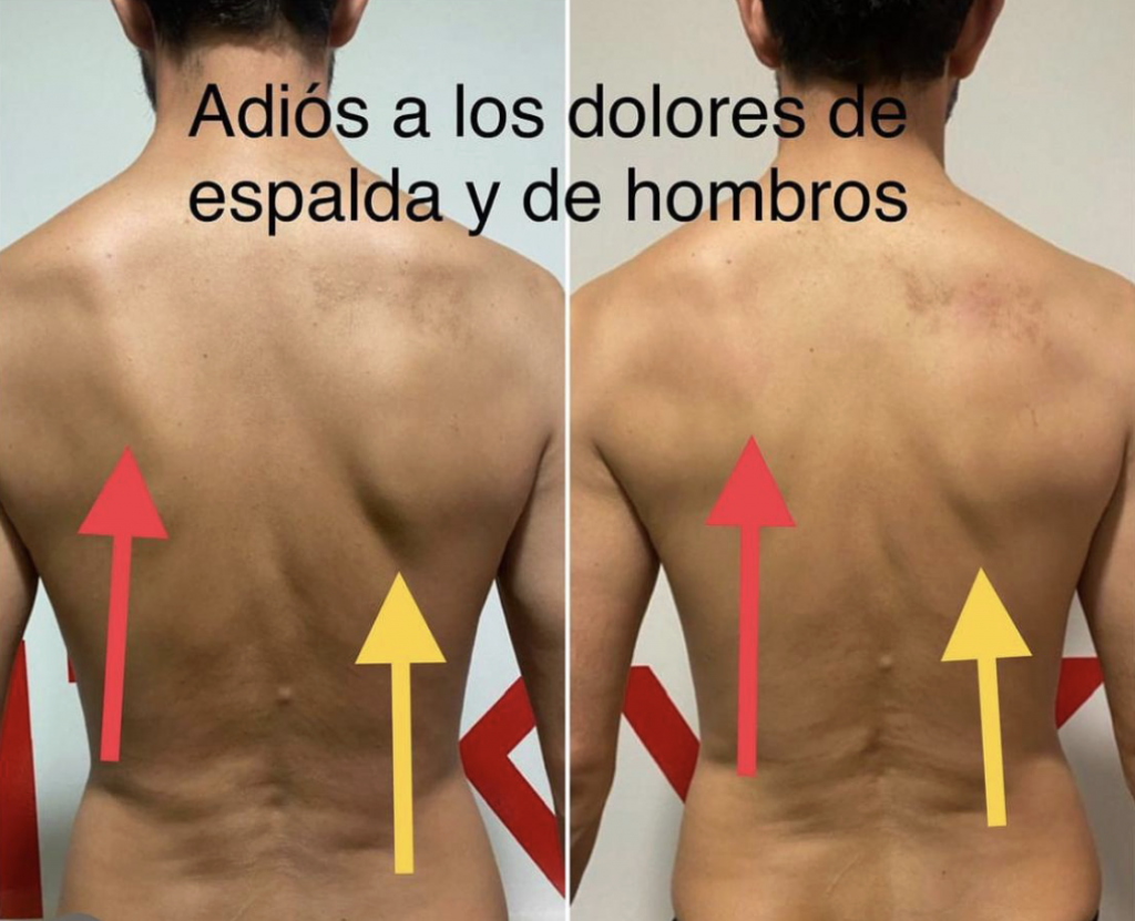 Marcos Martín trabajando en corregir la postura en Madrid con un cliente en Yoofit Chamartín