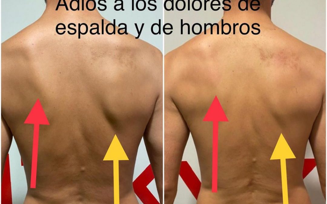Cómo corregir la postura en Madrid: 5 claves con un entrenador personal